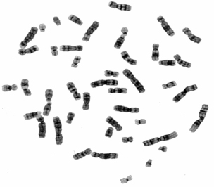 Рисунок 2. Как выглядят хромосомы под микроскопом